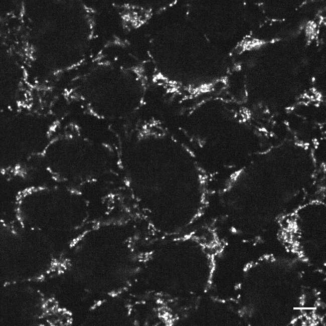 [object Object] thumbnail