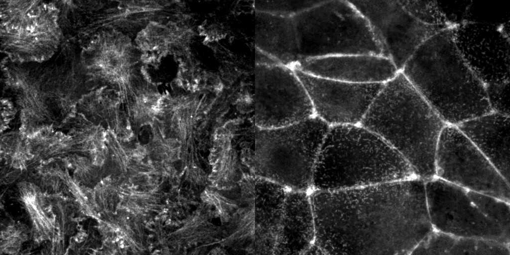 [object Object] thumbnail