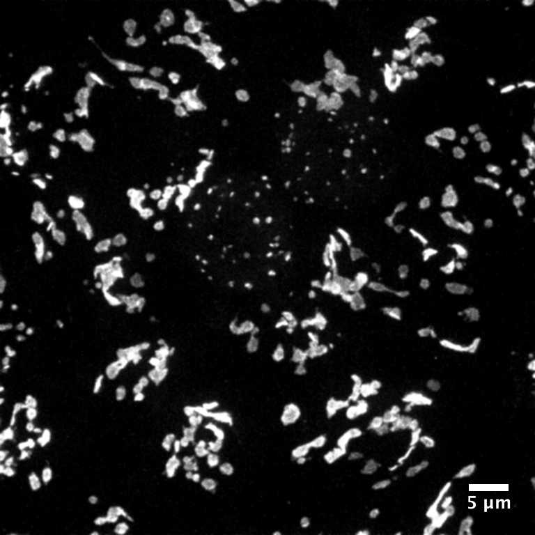 [object Object] thumbnail