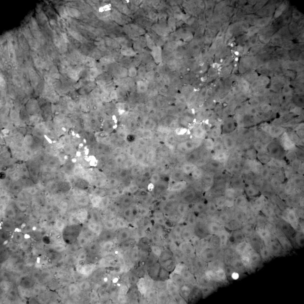 [object Object] thumbnail