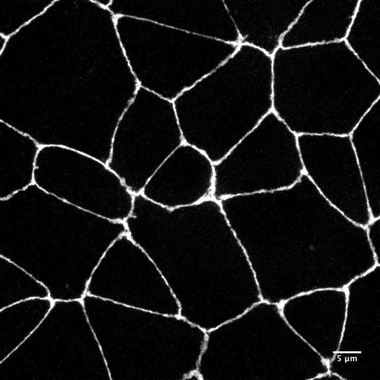 [object Object] thumbnail